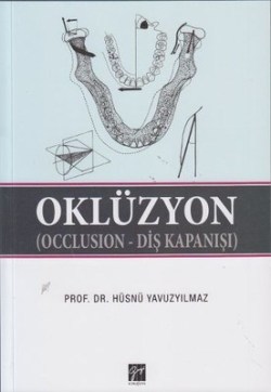 Oklüzyon